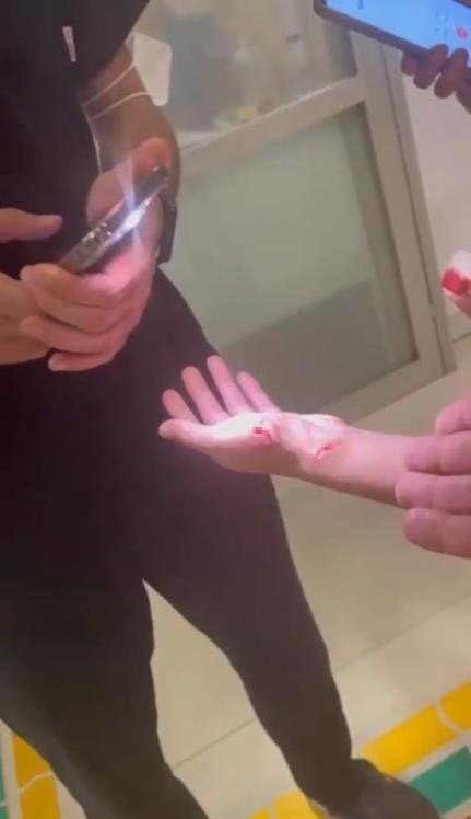 Antalya’da Elinde Kesi Bulunan Kızı Acil Servisten Geri Çeviren Özel Hastane: "başvuru Sırasında Kırmızı Alanda 3 Hasta Vardı, Kesi Yeni Değildi"