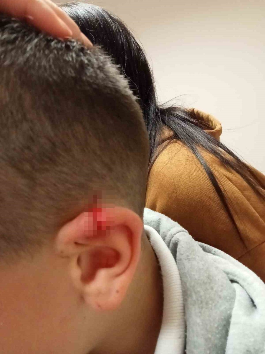 Eskişehir’de İlkokul Velisinin ‘pes’ Dedirten İddiaları