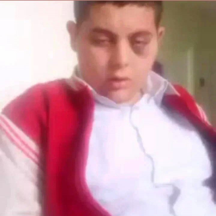 Otizmli Genç, Geçen Yıl Da Doğum Gününde Darbedilmiş