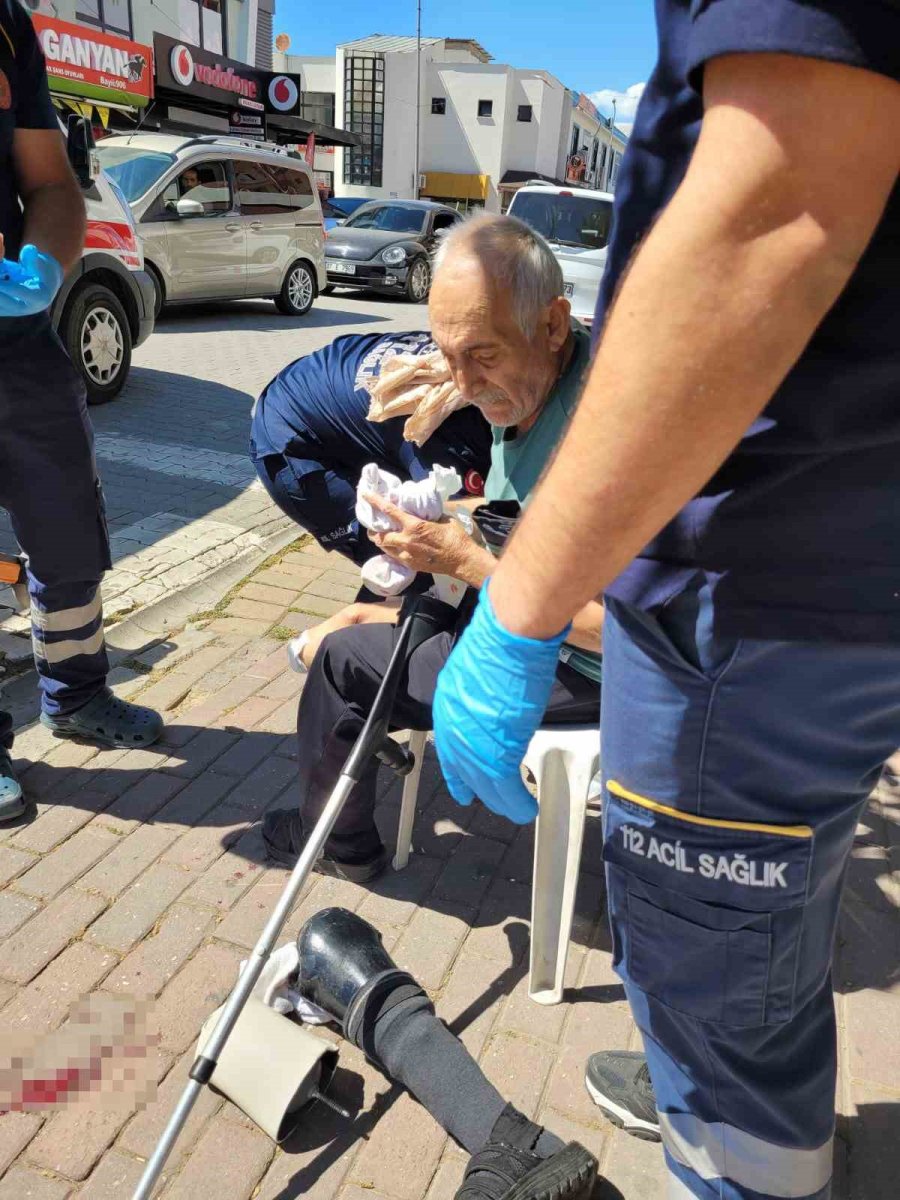 Yürürken Protez Bacağı Çıkan Yaşlı Adam, Protez Demirinin Kestiği Bacağından Yaralandı
