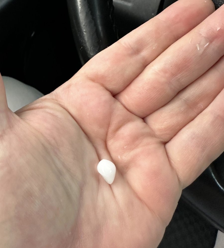 Kayseri’de Dolu Yağışı Etkili Oldu