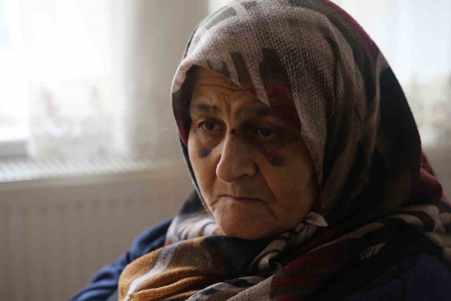 Hem Ters Hem De Geri Geri Gelip Çarptığı Yaşlı Kadının Hayatını Kararttı