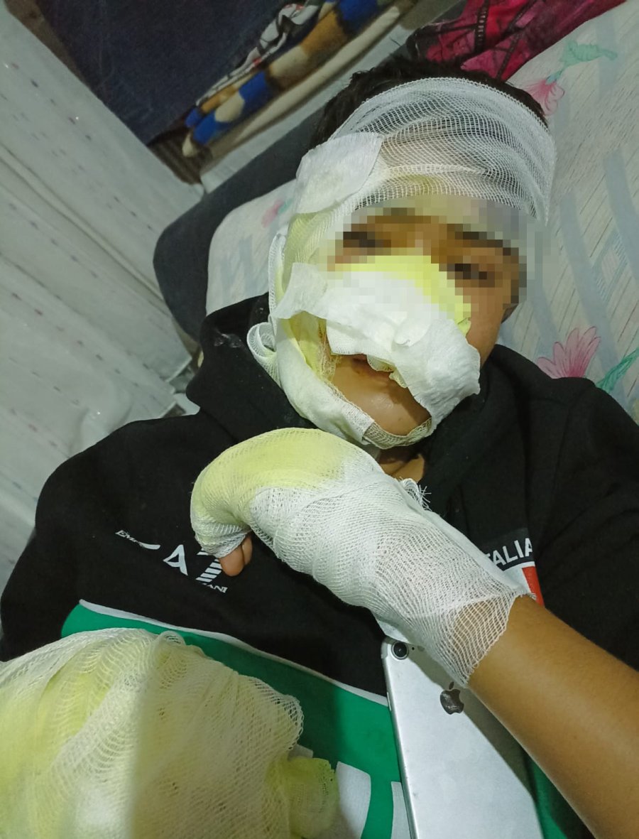 Önce Fırına Kilitlediler Sonra Dereceyi Artırdılar