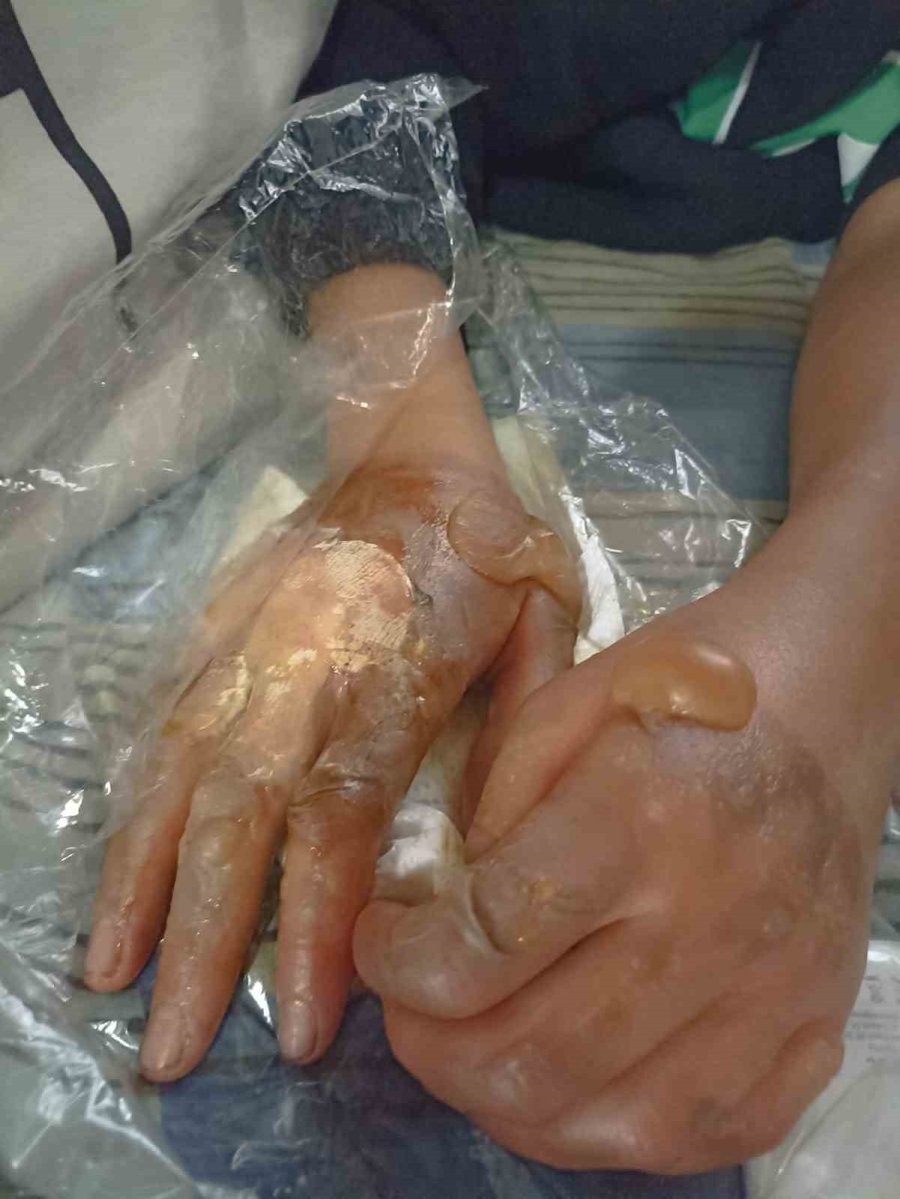 Önce Fırına Kilitlediler Sonra Dereceyi Artırdılar