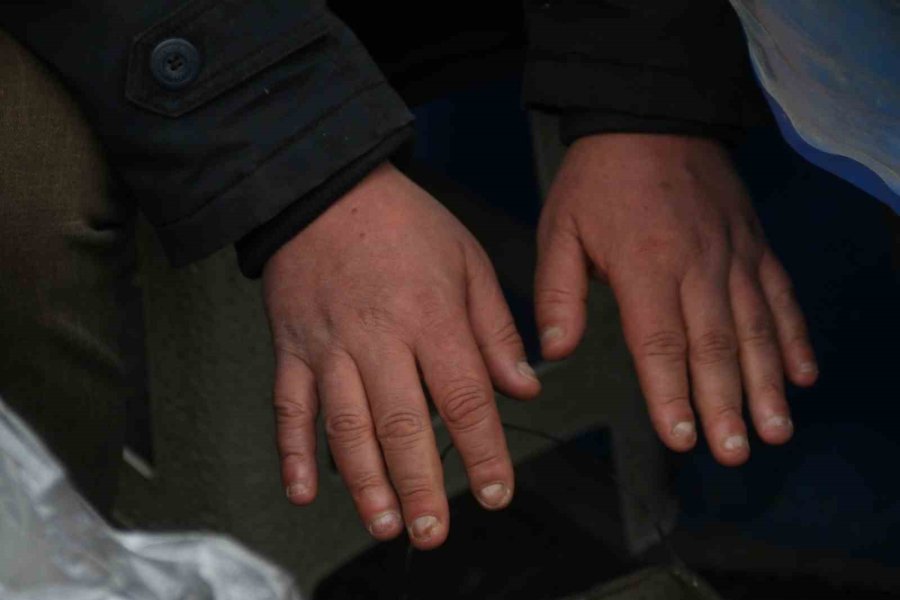 Cildi Soğuktan Korumayı Sağlayacak Öneriler