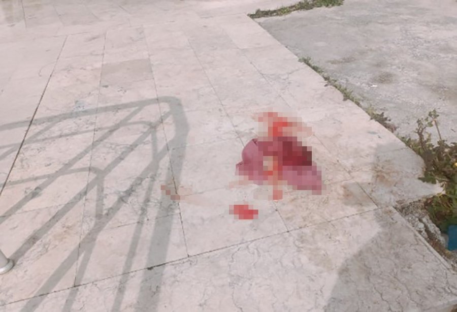 Alanya’da 4. Kattan Düşen Kadın Hayatını Kaybetti