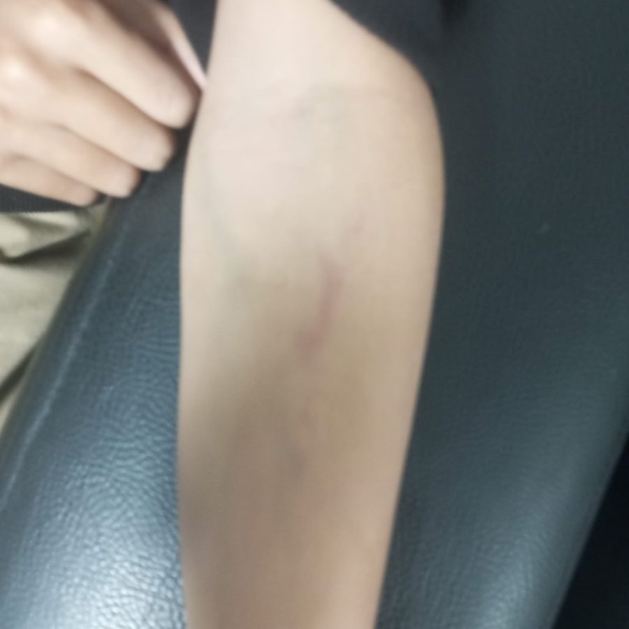 Antalya’da Öğretmeninin Darp Ettiği İleri Sürülen Çocuğun Ailesi Şikayetçi Oldu