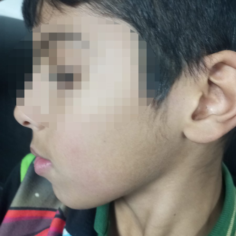 Antalya’da Öğretmeninin Darp Ettiği İleri Sürülen Çocuğun Ailesi Şikayetçi Oldu