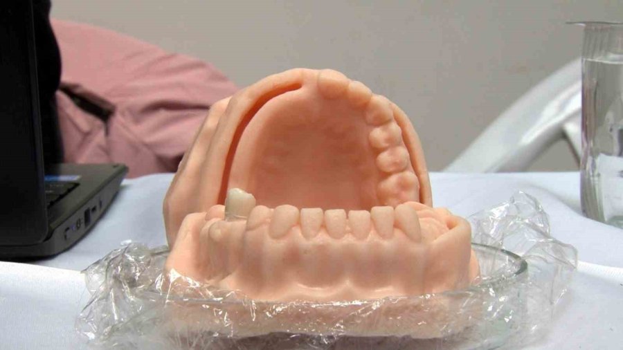 Balık Pulundan Organik ‘diş Dolgusu’