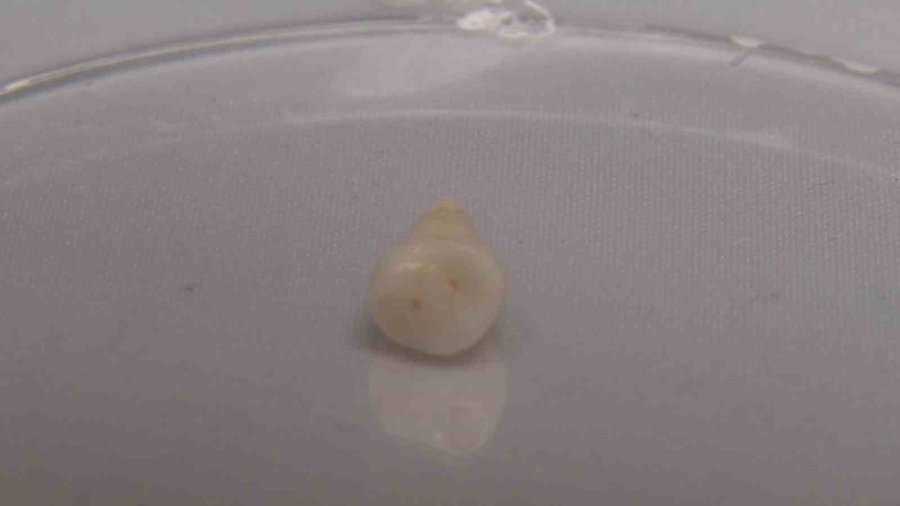 Balık Pulundan Organik ‘diş Dolgusu’