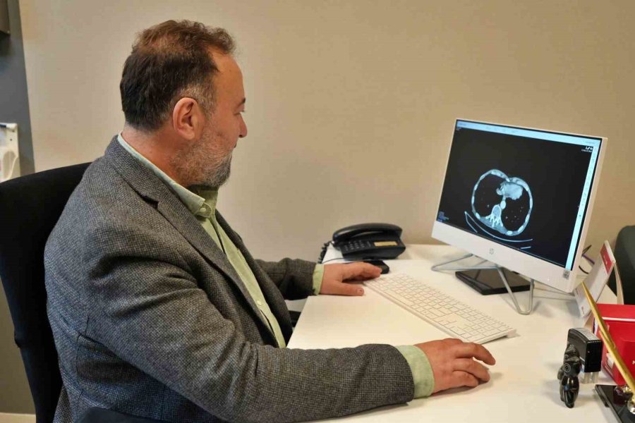 Koleraktal Kanserler Türkiye’de En Sık Görülen Üçüncü Kanser