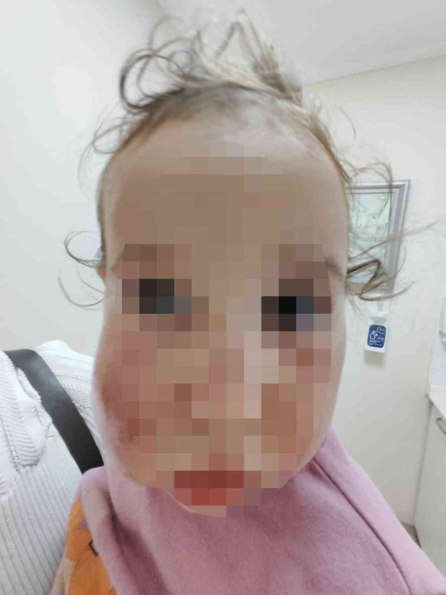 Antalya’da 2 Yaşındaki Çocuğa Kreşte Akran Zorbalığı İddiası