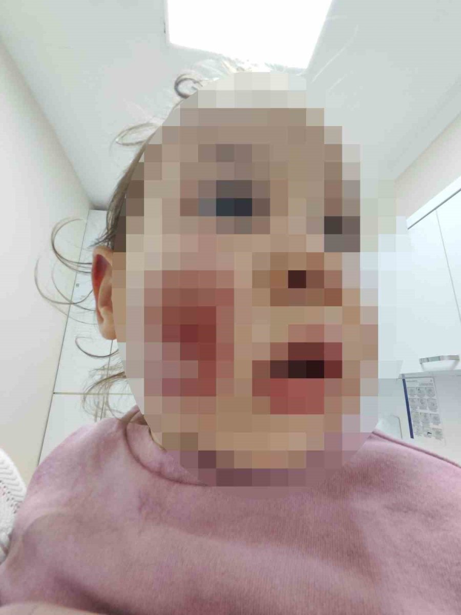 Antalya’da 2 Yaşındaki Çocuğa Kreşte Akran Zorbalığı İddiası