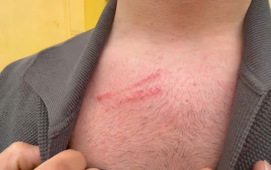 Kına Gecesi Bitiminde Egzoz Sesi Çıkaran Gelin Arabasını Uyardı, Damadın Saldırısına Uğradı