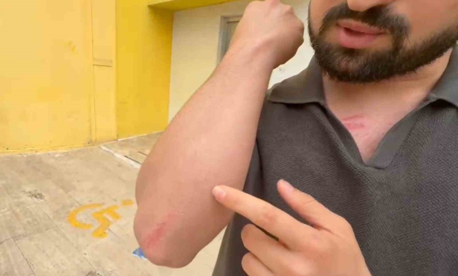 Kına Gecesi Bitiminde Egzoz Sesi Çıkaran Gelin Arabasını Uyardı, Damadın Saldırısına Uğradı