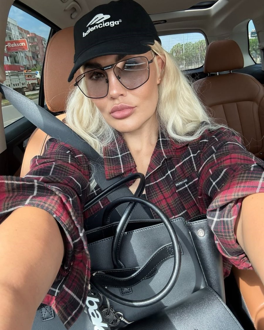 Kanseri Yenmek İçin Türkiye’yi Seçen Ukraynalı Modele ‘1 Cm’ Delikten Gelen Şifa