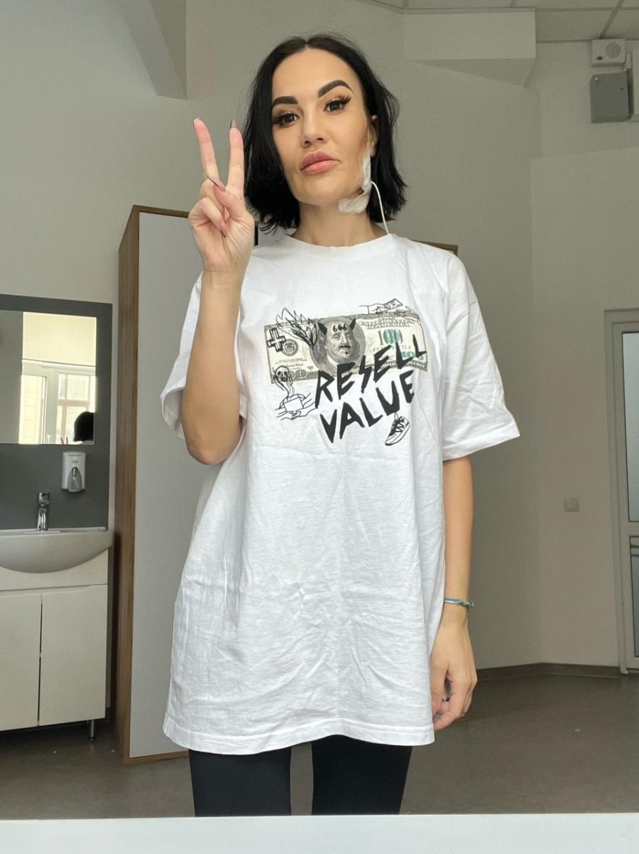 Kanseri Yenmek İçin Türkiye’yi Seçen Ukraynalı Modele ‘1 Cm’ Delikten Gelen Şifa