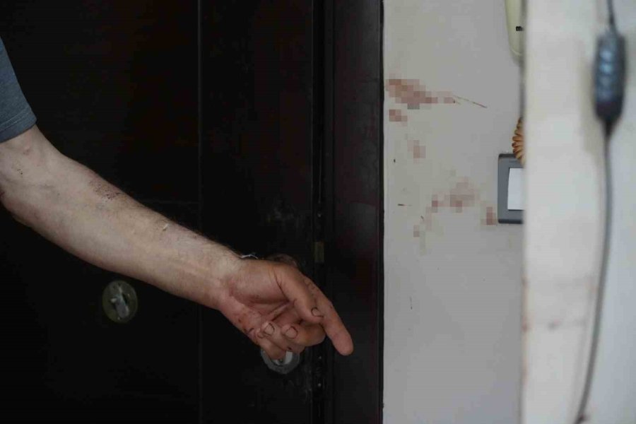 Hakkında Uzaklaştırma Kararı Bulunan Adam, Barışma Çağrısıyla Gittiği Evde Eşi Tarafından Defalarca Bıçaklandı