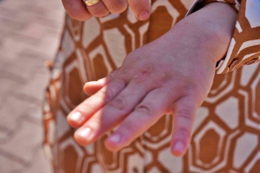 İşe Giden Kadına Çarpıp Kaçtı, Plakası Ve Tamponu Olay Yerinde Kaldı