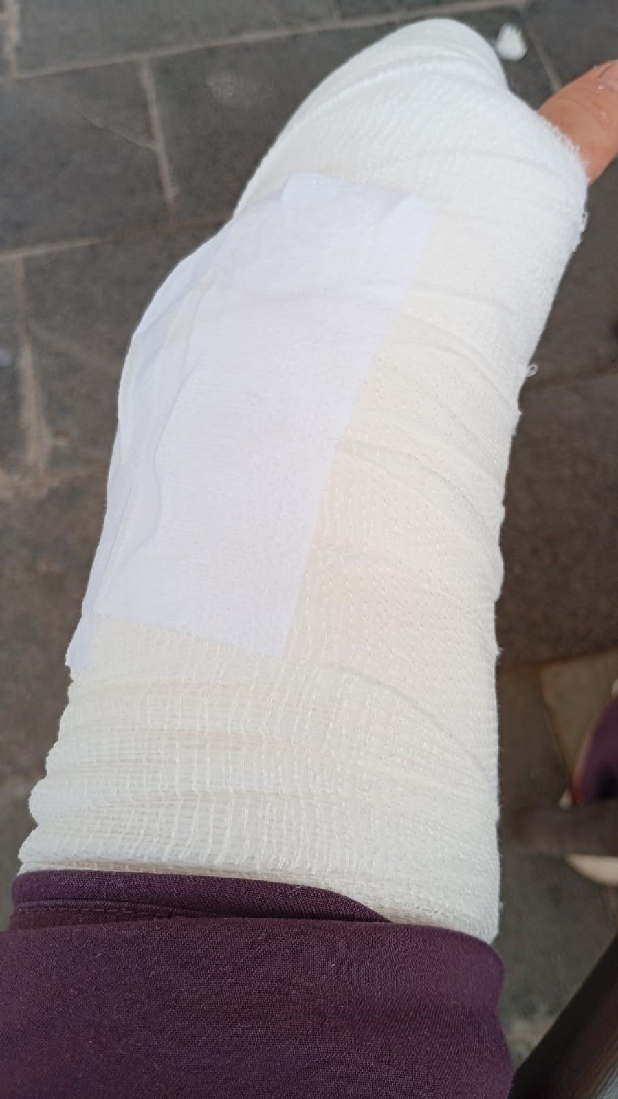 İşe Giden Kadına Çarpıp Kaçtı, Plakası Ve Tamponu Olay Yerinde Kaldı