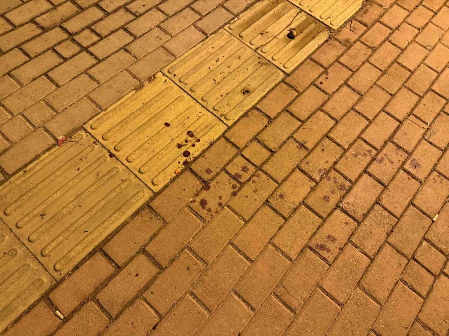 Cama Yumruk Atan Çocuk Ağır Yaralandı