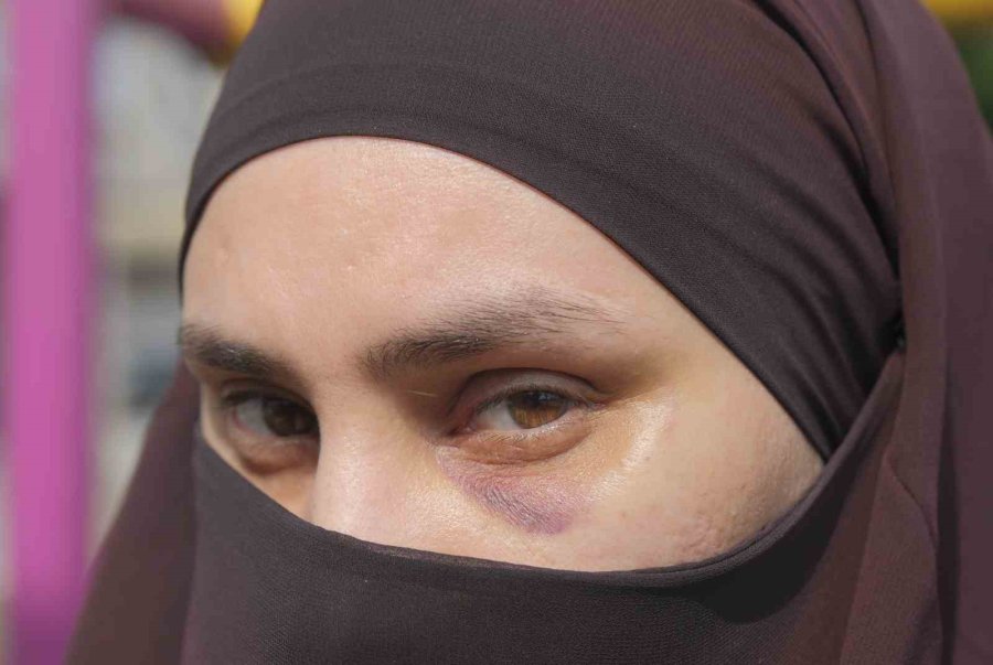 Mersin’de Bir Kadın, Çocuklarının Önünde Darbedildi