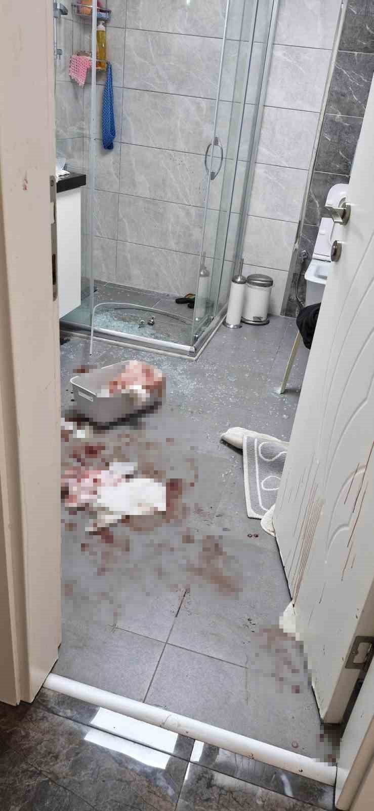 Duşakabin Patladı, Eline 20’ye Yakın Dikiş Atıldı