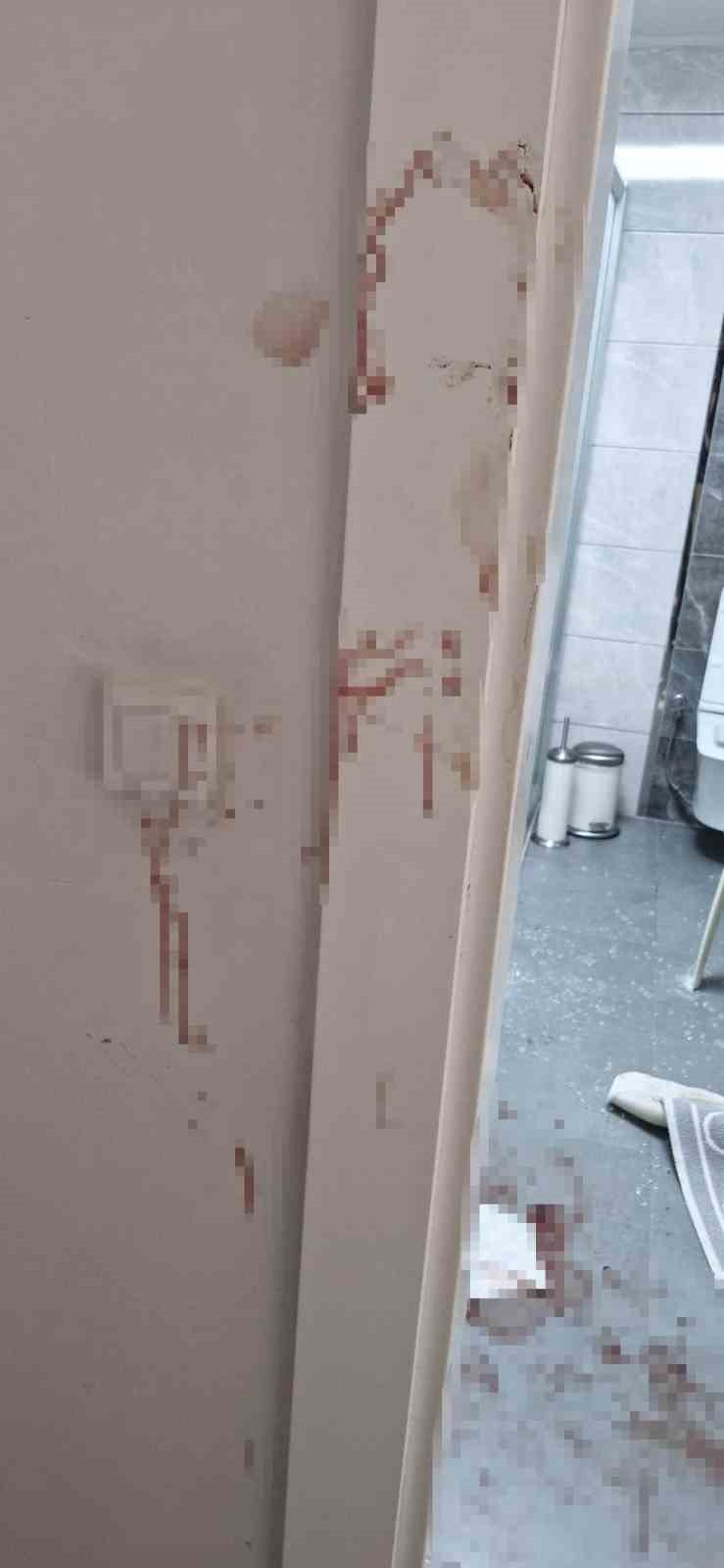 Duşakabin Patladı, Eline 20’ye Yakın Dikiş Atıldı