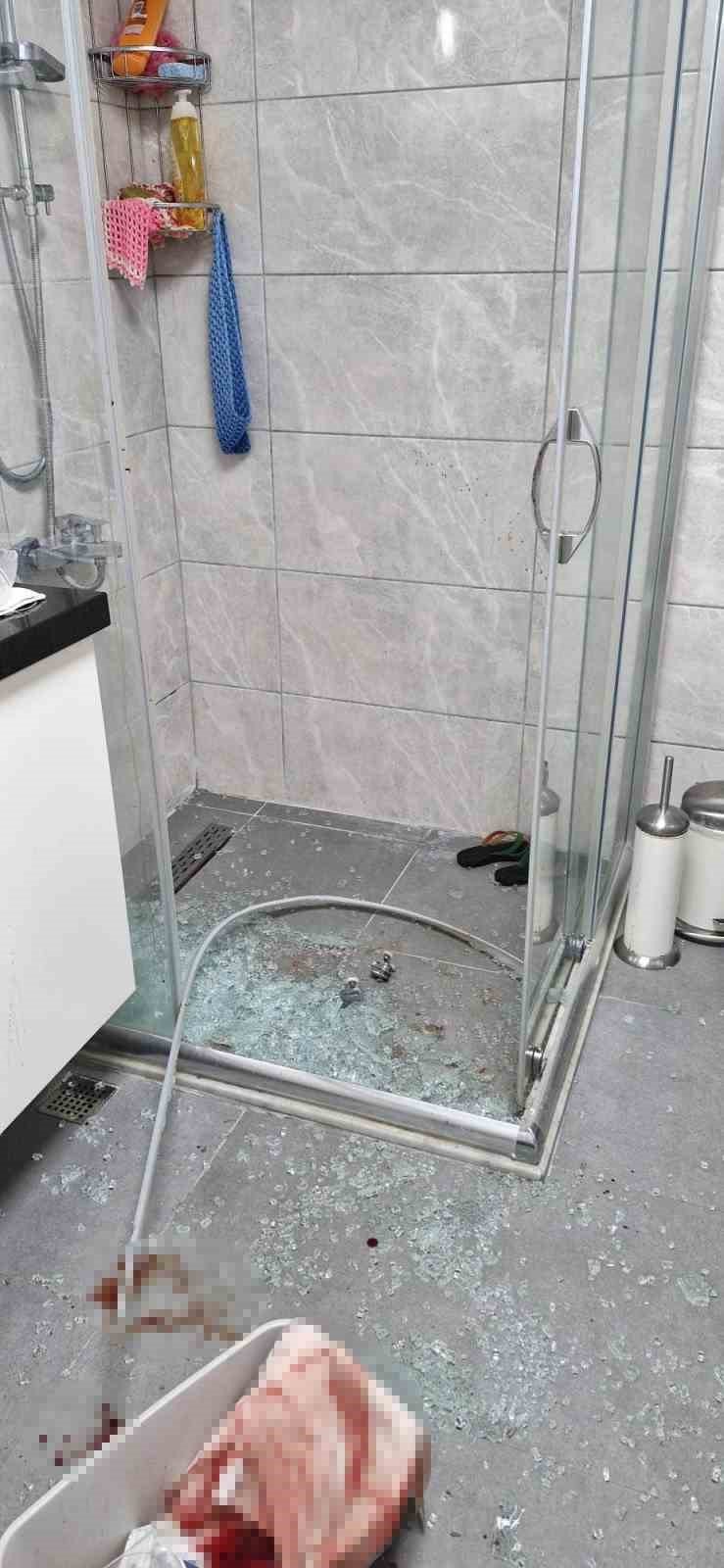 Patlayan Duş Kabininde Yaralandı, 1 Aydır Direksiyon Başına Geçemiyor