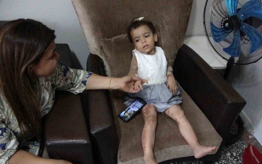 Küçük Ayşe Yaşam Savaşını Kazandı, Özel Tedaviyle Hayata Tutundu