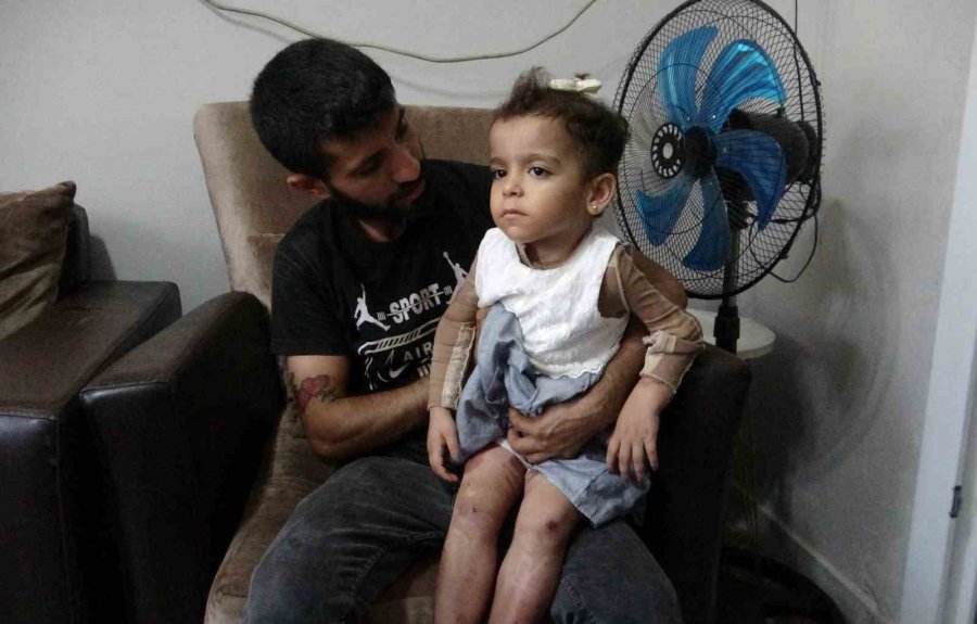 Küçük Ayşe Yaşam Savaşını Kazandı, Özel Tedaviyle Hayata Tutundu