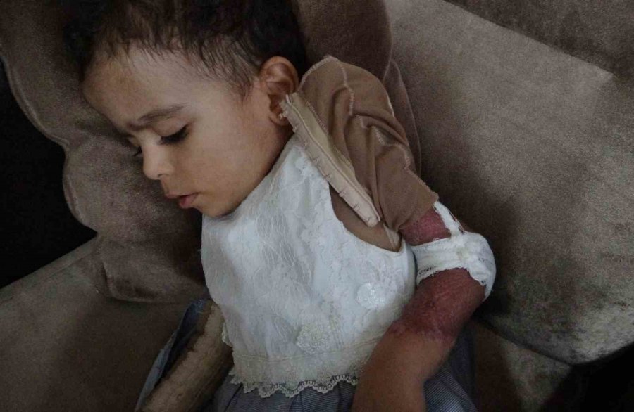 Küçük Ayşe Yaşam Savaşını Kazandı, Özel Tedaviyle Hayata Tutundu