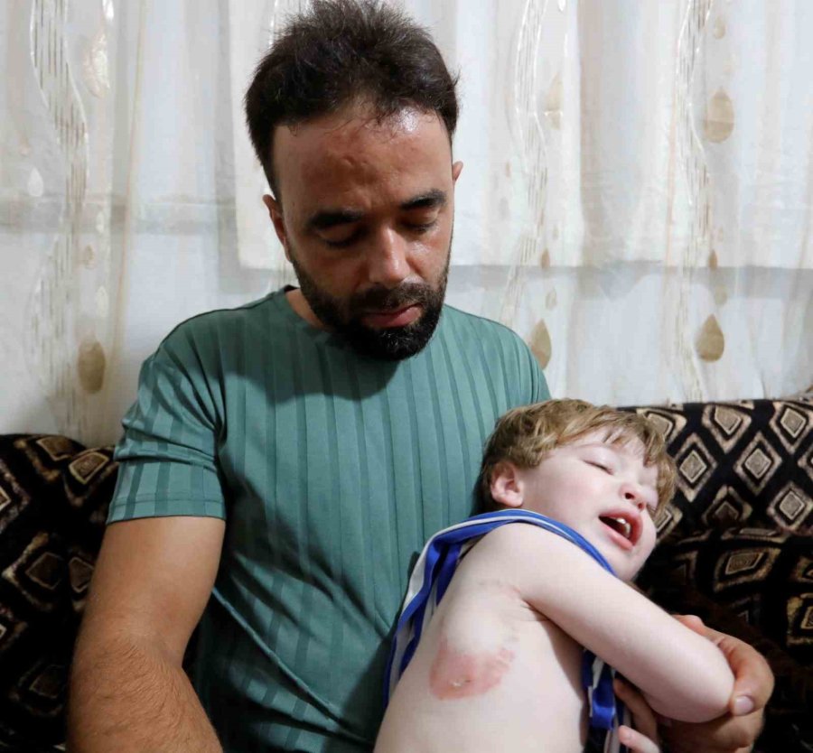 Attan Beklenmedik Hareket: Babasının Kucağındaki Çocuğu Isırarak Alıp Havaya Fırlattı