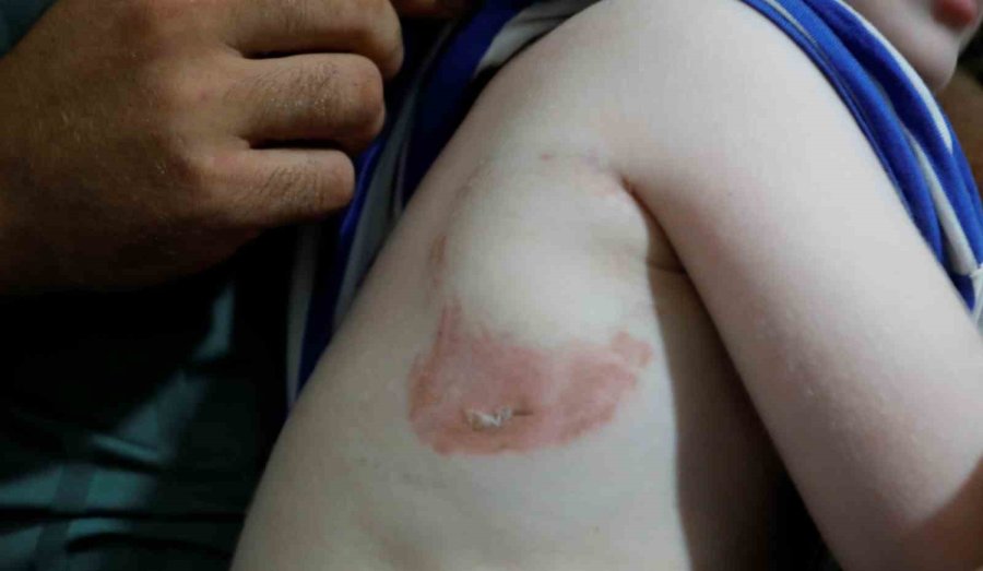 Attan Beklenmedik Hareket: Babasının Kucağındaki Çocuğu Isırarak Alıp Havaya Fırlattı