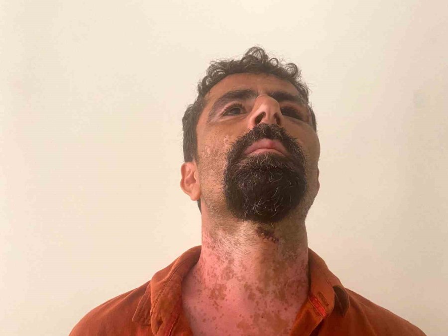 Antalya’da Öfkeli Damat Kayınpederini Hastanelik Etti