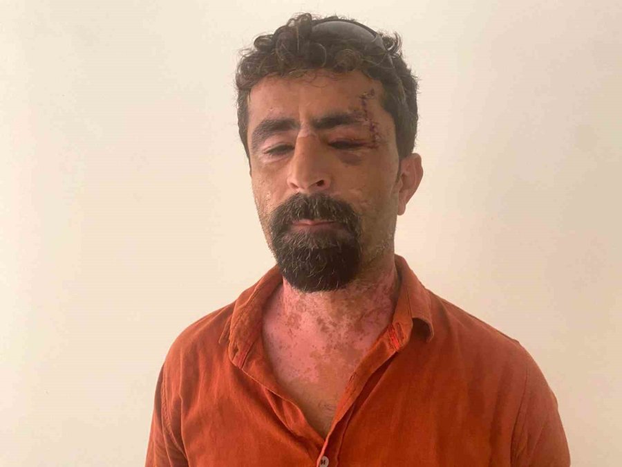 Antalya’da Öfkeli Damat Kayınpederini Hastanelik Etti