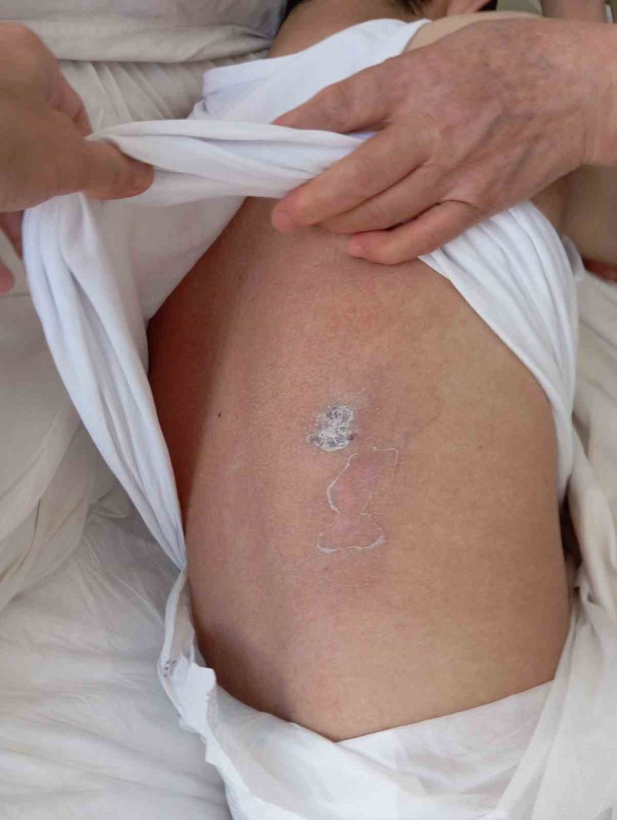 Yürüyerek Özel Bakım Merkezine Götürdüğü Torununu Yoğun Bakımda Aldı