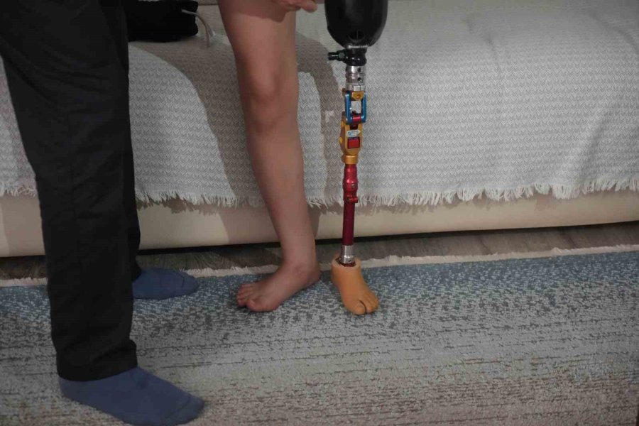 Okulların Açılmasına Günler Kala 12 Yaşındaki Özge’ye Dar Gelen Protez Bacak Engeli