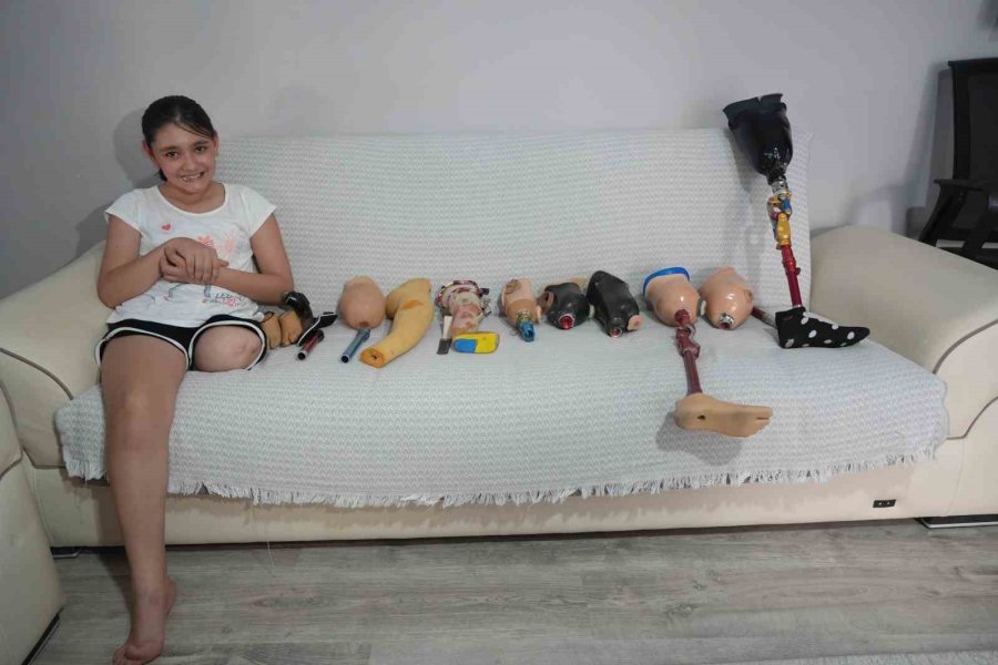 Okulların Açılmasına Günler Kala 12 Yaşındaki Özge’ye Dar Gelen Protez Bacak Engeli