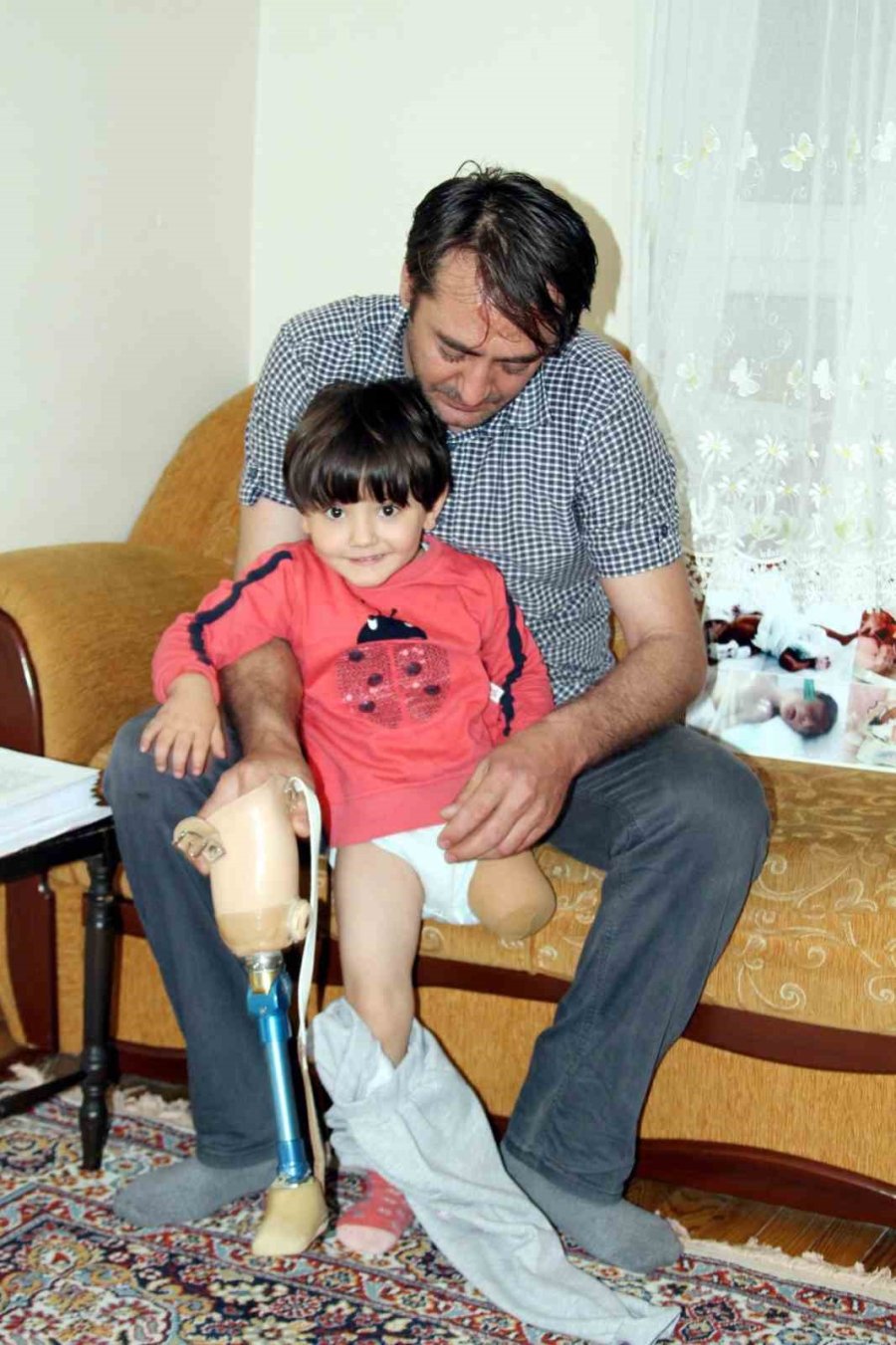 Protez Bacağı Dar Gelen Özge İçin Türkiye Ayağa Kalktı