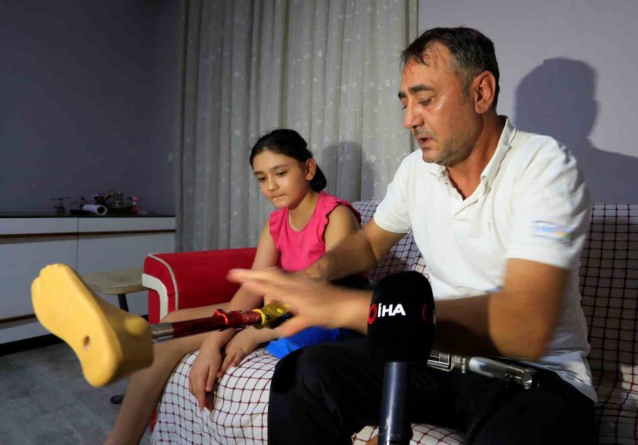 Protez Bacağı Dar Gelen Özge İçin Türkiye Ayağa Kalktı