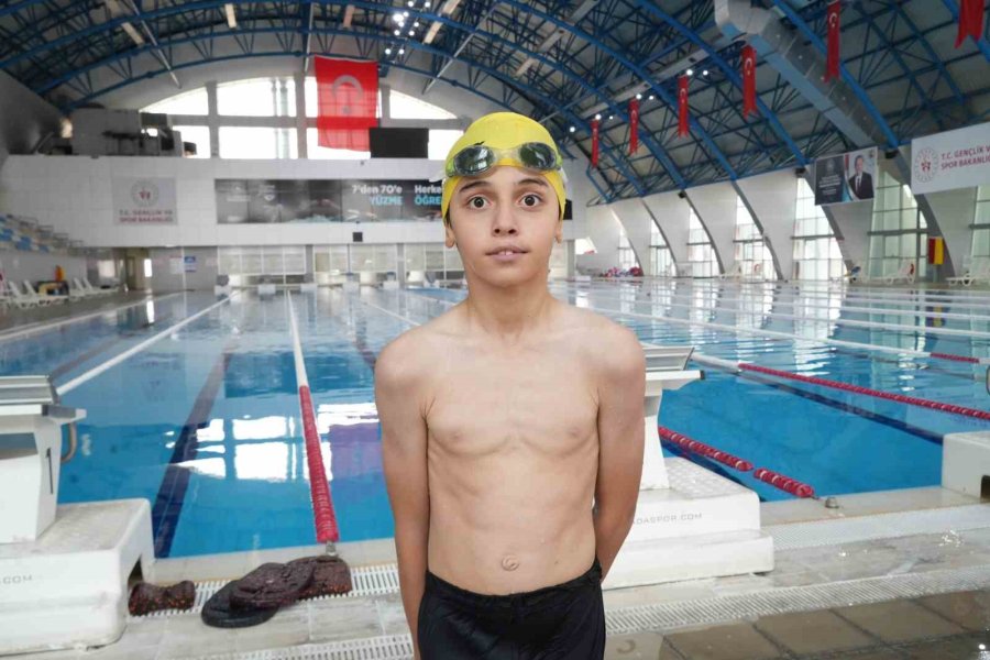 Ampute Sporcu Ahmet Yasin, Yüzme Tutkusuyla Engelleri Aşıyor