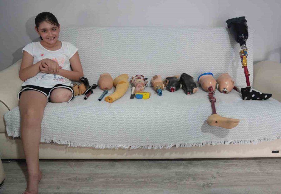 Özge Protez Bacağına Kavuşuyor Okula Gitmek İçin Gün Sayıyor