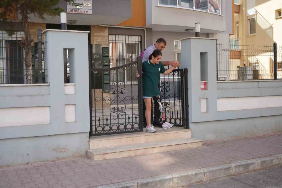 12 Yaşındaki Özge Yeni Protezine Kavuştu, Okul Heyecanı Yeniden Başladı
