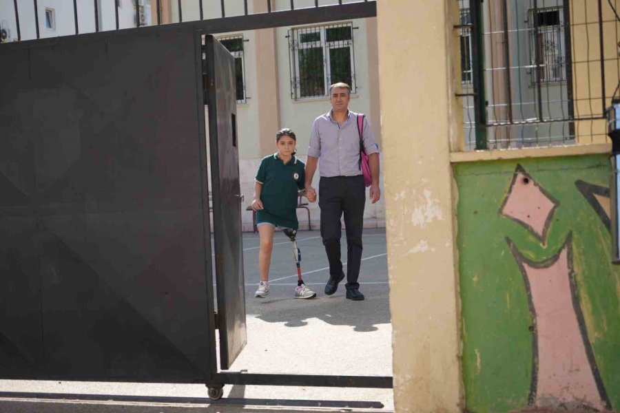 12 Yaşındaki Özge Yeni Protezine Kavuştu, Okul Heyecanı Yeniden Başladı