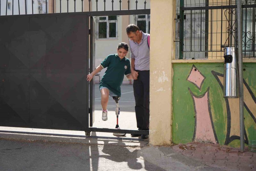 12 Yaşındaki Özge Yeni Protezine Kavuştu, Okul Heyecanı Yeniden Başladı