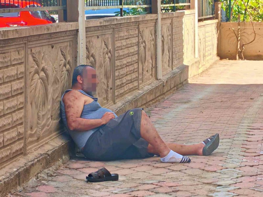 Eline Aldığı Tiner Şişesi Ve Çakmakla Kendini Yakmak İstedi