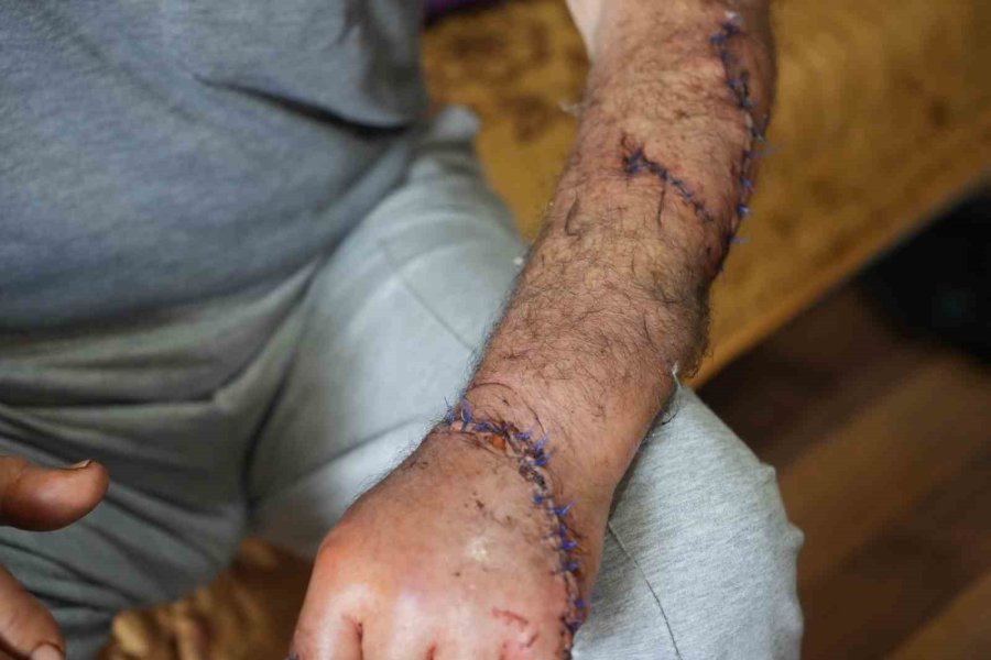 Kendisini Bıçaklayıp Uzaklaştırma Alan Eşini Bankta Yatarken Görüp Eve Aldı, Kendi Evsiz Kaldı