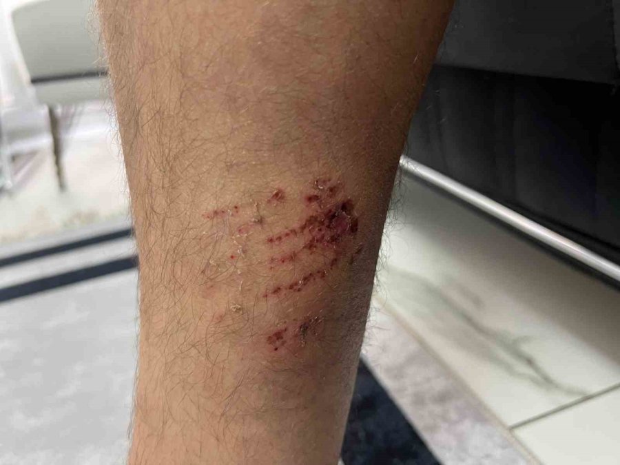 Köpek Dehşetinin Mağduru Motokurye O Anları Anlattı: "köpek Kafasını Çırpabilseydi Etimi Koparabilirdi"