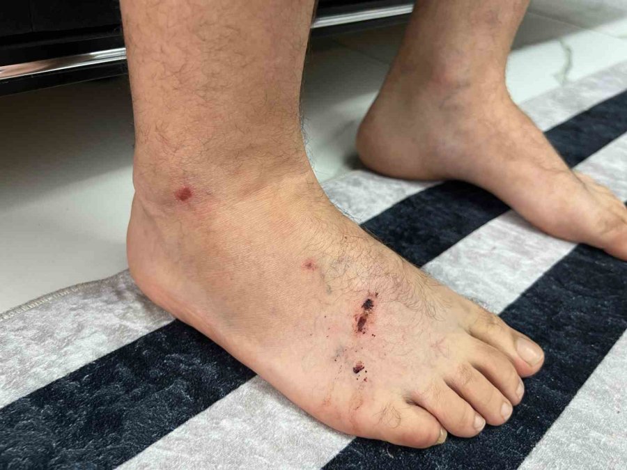 Köpek Dehşetinin Mağduru Motokurye O Anları Anlattı: "köpek Kafasını Çırpabilseydi Etimi Koparabilirdi"